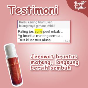 ACNE PEEL SR12 / Peeling Jerawat / Mengurangi Jerawat / Peeling Kulit Berjerawat / Jerawat Batu