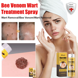 【MISUIY】[Bee Venom Wart Treatment Spray]蜂毒克疣护理喷雾Clean Fade Body Moles Smooth Skin Repair Anti-Wart Cream/Anti-Spot Liquid