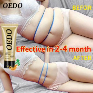 OEDO Axit hyaluronic Kem giảm béo nhân sâm giảm cân Cellulite Giảm cân Giảm béo Đốt cháy chất béo Kem giảm béo Wellness - Kem giảm béo - Tẩy chất béo - Giảm cân - Kem làm tan mỡ - Giảm béo bụng - Giảm béo - intl