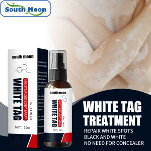 【Hot Sale】south Moon Vitiligo Cream Vitiligo Ointment Antibacterial Cream Psoriasis Local Vitiligo Ointment Skin Leukoplakia Treatment Spray Free Mini Skin Leukoplakia Treatment Spray For External UseLeukoplakia Disease Pigment Melanin Repair Body （30