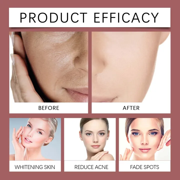 West%20Month%20Intensive%20Peeling%20Solution%20Soothes%20Skin%20Softens%20Texture%20Refines%20Pores%20Appearance%20Skin%20Care%2030ml%20-%20Image%208
