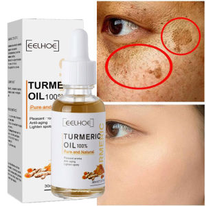 30ml Pure Turmeric Essential Oil Freckle Whitening Serum Brighten Fade Acne Dark Spot Pigmentation Melanin Corrector Moisturizing Beauty Face Skin Care