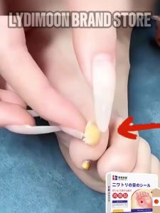 Fast Shipping Japan Wart Removal Patch Foot Corn Remover Corn Plaster Removal of Warts on Hands and Feet Skin Tag 鸡眼贴/足部护理贴  Cod