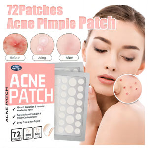 360PCS Acne Pimple Patches Effective Waterproof Hydrocolloid Stickers Pimples Removal Facial Skin Care