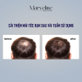 Tinh chất khắc phục rụng tóc Kaminomoto Higher Strength Nhật Bản chính hãng. 