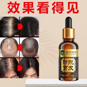 [ Hair Loss and Hair Loss ]💗🙋‍♀️💗 Hair Growth Serum for Thickening Hairline Hair Growth Nutrient Essence for Men and Women Anti-Hair Loss Magic