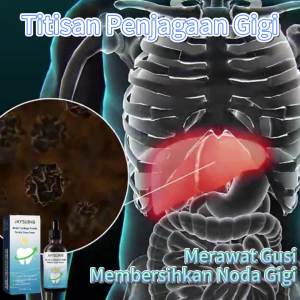 Jaysuing Teeth Care Drops Deep Cleaning Tooth Stains Tartar Gum Swelling Pain Gum Protection Dental Care