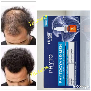 Xịt mọc tóc cho nam Phyto Phytocyane Men Densifying Hair Serum - hộp 12 ống - ✔ Bổ sung dưỡng chất cần thiết cho chân tóc chắc khỏe.✔ Tăng cường lưu thông máu da đầu nuôi dưỡng nang tóc.✔ Giúp tóc dày khỏe bóng mượt và tự tin hơn.