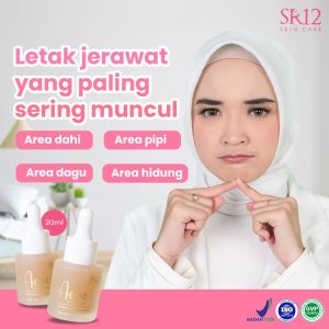 Acne serum membantu mengatasi jerawat dan pori-pori