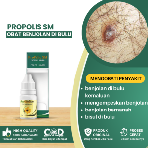 Obat Benjolan Di Bulu Kemaluan Obat Mengempeskan Benjolan Kelamin Pria Dan Wanita Obat Benjolan Di Bulu Kemaluan Obat Benjolan Bernanah Di Kelamin Obat Gatal Di Bulu Kemaluan Obat Bisul Di Bulu Kemaluan Obat Benjolan Bernanah - PROPOLIS SM