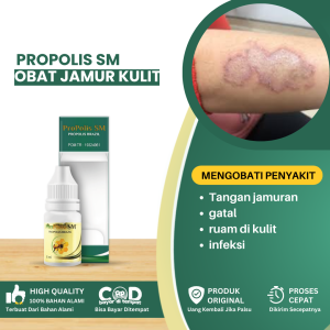 Obat Jamur Kulit Obat Gatal Obat Untuk Penghilang Jamur Obat Tangan Jamuran Obat Untuk Penghilang Jamur Obat Jamur Di Kulit Kepala Obat Jamur Kepalaulit Alami Obat Jamur Kulit Bernanah Obat Infeksi Ruam Gatal Di Kulit - Propolis SM