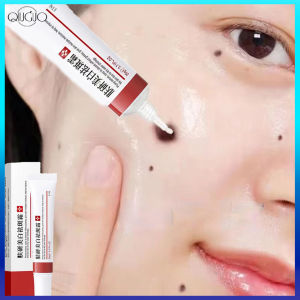 Effective Whitening Freckle Cream Remove Melasma Acne Dark Spot Melanin Pigmentation Moisturizing