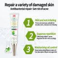 Acne Cream whitening moisturizing cream acne removal essence 30g facial essence cream scar acne remo Pimple Eraser. 