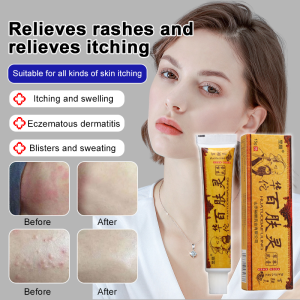 Smooth fine and tender AntiItch Cream Lit all skin spirit (idiom) fig all skin types Suitable for all kinds of skin itching Fast results Bubbly Herbal Mild Skin Friendly