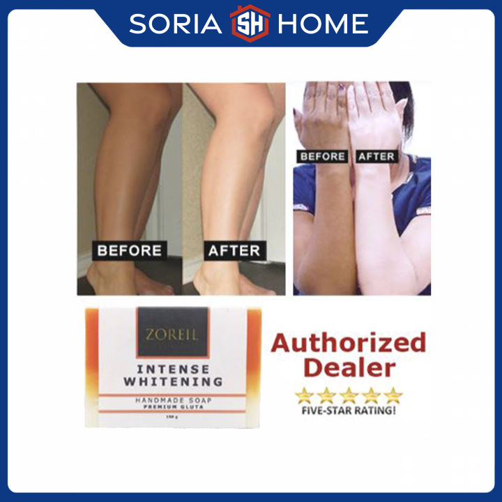 Effective Glutathione Kojic Bleaching Soap for Skin Lightening Pigmentation  Scars Blemishes Sun Spots Dark Spots Acne Scars Fast Results Anti Aging  Ultra Lightening Soap | Lazada PH