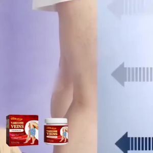 South Moon Varicose Veins Ointment  Smooth Blood Vessels Smooth Bulge Earthworm Legs  Vein Venous Massage Cream Remover Pain Treatment for Varicose Removal Cream Swelling Relieve Body Care Ointment