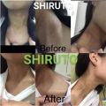 【Buy 2 free 1】 Shiruto BElixz Vitamin for Immute System Immune Vitamin Japan Original 100 Quality Guarantee shiruto Supplement 1 CoreNutri Market. 