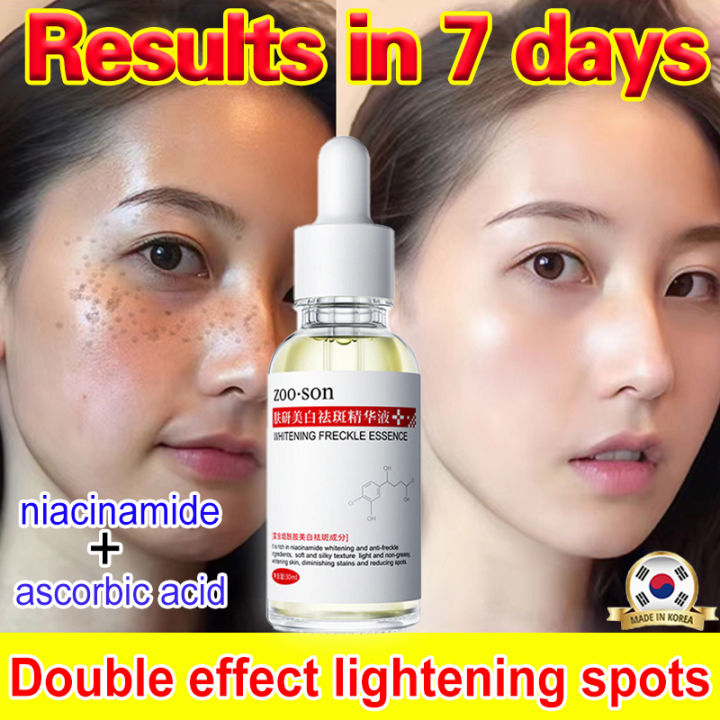 ZOO SON Whitening Freckle Essence Effective Removal Melasma Anti Aging ...