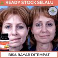 Obat Bells Palsy, Obat Bibir Miring, Obat Untuk Bibir Miring, Obat Wajah Turun Sebelah, Obat Wajah Tidak Simetris, Obat Untuk Otot Wajah Lemah, Obat Wajah Kaku Sebelah, Obat Wajah Turun Sebelah, Obat Penyakit Bells Palsy Dengan Kapsul Gamat Emas. 