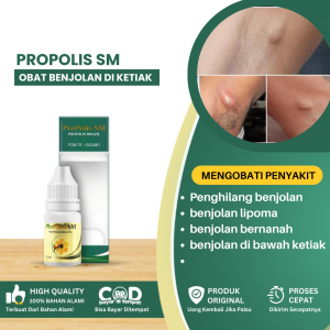 Obat Benjolan Di Ketiak Obat Penghilang Benjolan Di Ketiak Obat Benjolan Lipoma Di Ketiak Obat Benjolan Bernanah Di Ketiak Obat Benjolan Di Bawah Ketiak Obat Benjolan Diketiak Obat Untuk Benjolan Bawah Ketiak - PROPOLIS SM