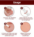 H Wart Removal Liquid Pen/Mole removal care pen 3ml. 