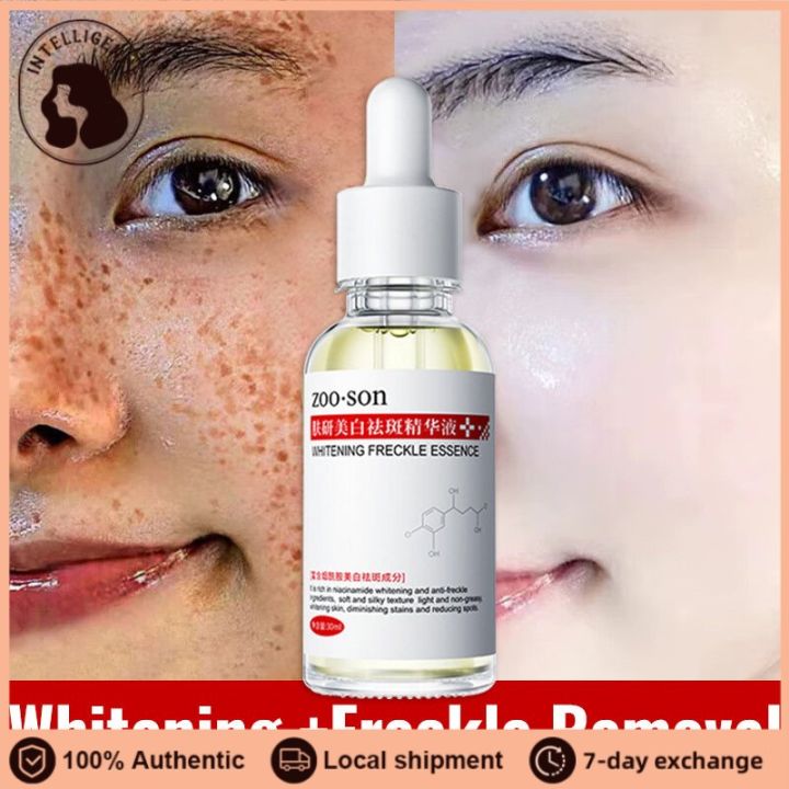 IE Melasma Serum Remover Melasma and pekas Original