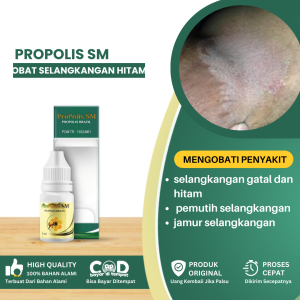 Obat Selangkangan Hitam Obat Selangkangan Gatal Dan Hitam Obat Pemutih Selangkangan Obat Herbal Tetes Selangkangan Hitam Obat Selangkangan Gatal Obat Jamur Selangkangan - Propolis SM