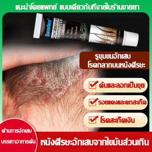 สะเก็ดเงิน หนังศรีษะ สำหรับโรคผิวหนัง สะเก็ดทอง กลากเกลื้อน เชื้อรา แก้อักเสบ ผื่นแพ้ คันลมพิษ ผิวหนังอักเสบ รังแค สิว รูขุมขนอักเสบบนหนังศีรษะและใบหน้า