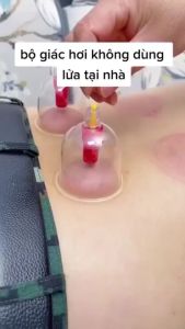 Bộ Giác Hơi 12 Món Không Dùng Lửa Tặng kèm Dây Nối Chữa Đau Lưng Đau Đầu Nhức Mỏi Điều Hoà Kinh Mạch Phukienprocare