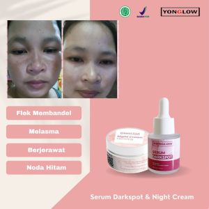 Paket 2in1 Serum Darkspot Night Cream Krim Malam Yonglow Skincare Formulasi dr Yong Serum Penghilang Flek Melasma Membandel Serum Penghilang Noda Hitam Pemutih Kulit Wajah Glowing Resmi BPOM