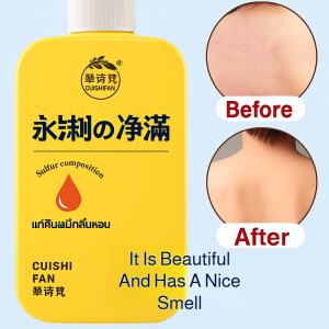 Sulfur Shower Gel Antibacterial Reduces Itching Says Goodbye Mites Acne Deep Cleanses Liquid Soap硫磺抑菌止痒嫩肤