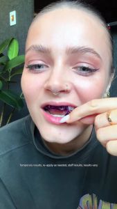 New Promo Hismile V34 Whitening Strips Teeth Whitening Strips Purple Tooth Whitening Tooth Stain Treatment