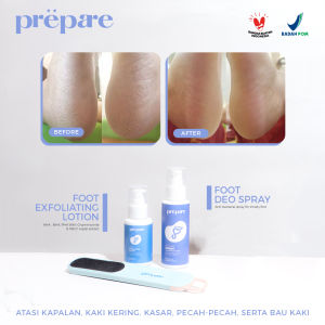 PREPARE Foot Cream Solution Perawatan Kaki Kering Tumit Pecah Pecah dan Kapalan Foot Soak Concentrate