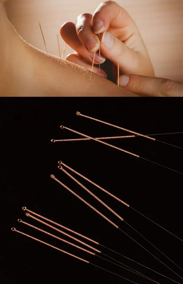 佳健针灸针紫铜柄毫针针灸专用针一次性中医非银针无菌医用| Lazada