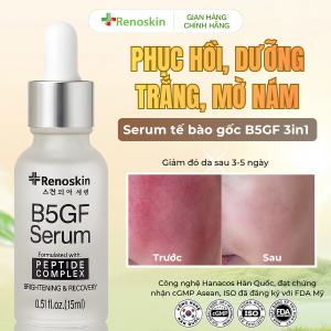 Bộ Sản Phẩm Ngừa Thâm Nám Phục Hồi Da Renoskin White Melasma Cream 30g và Serum B5GF 15ml Chính Hãng