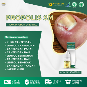 Obat Tetes Cantengan Obat Cantengan Jempol Kaki Obat Cantengan Jari Tangan Obat Cantengan Kuku Obat Cantengan Parah Dan Bau Obat Kuku Cantengan Obat Kuku Bernanah Obat Jamur Kuku Obat Kuku Kuning - Propolis SM Asli Original