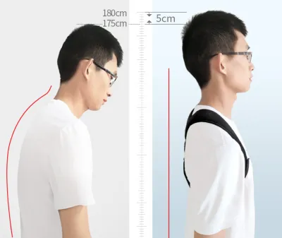 [HCM]Đai đeo điều chỉnh chống gù lưng thế hệ mới kyphosis nam và nữ trẻ em trưởng thành tư thế