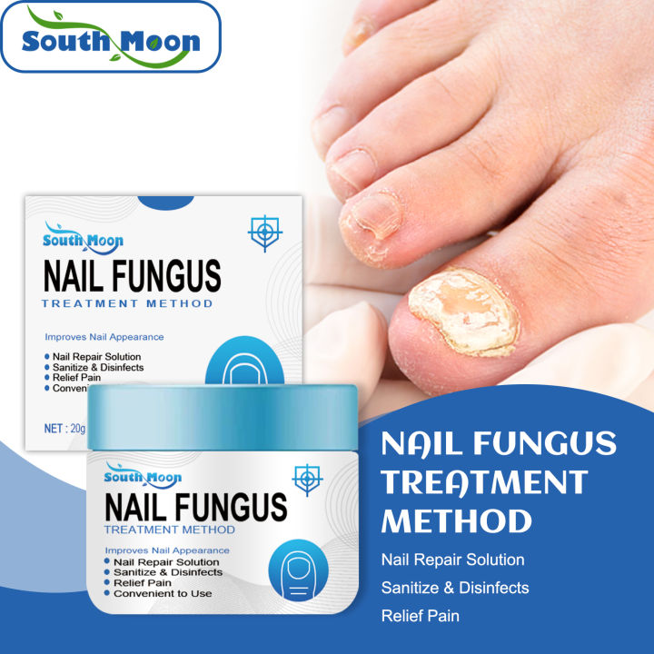 South Moon Nail Repair Cream Nail Fungus Treatment Method Onychomycosis ...