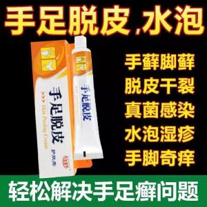 Hand & Foot Peeling Repair Cream – Anti-Cracking Moisturizing Skin Ointment 手足脱皮修护膏 护肤膏 干燥龟裂抑菌滋润膏