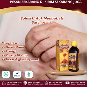 Kurmaqu GMJ - Obat Darah Manis Koreng Di Kaki Gatal Akibat Gigitan Nyamuk Prurigo Ruam Kemerahan