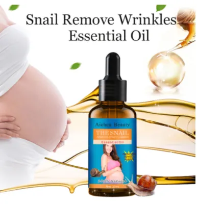 Personal Care Aichun Anti-stretch Mark Remover Lotion Cream For Pregnancy Repair Scar Slack Line Skin Care 【Aichun beauty】stretch mark lotion strech mark remover stretch mark remover Stretch Mark Remover Cream Pregnancy Scars Scars Remover Whitening Fad