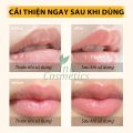 Set Dưỡng Môi Ngày Đêm Honey Lip Mask Giúp Dưỡng Môi Mềm Mịn, Giảm Viền Môi, Sửa Chữa Nuôi Dưỡng Môi. 