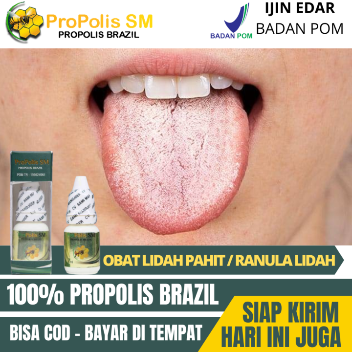 Obat Lidah Terasa Pahit, Mulut Pahit, Lidah Putih, Benjolan di Bawah ...