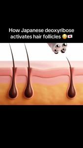 [medicube] Deoxyribose Scalp Serum    For Fuller-Looking Hair & Scalp Strengthening Roll-On Serum    Deoxyribose Rosemary EGF Caffeine for Fine