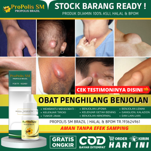 PROPOLIS SM BRAZIL 100% Original With Nano Technology - Obat Benjolan Obat Penghilang Benjolan Obat Kista Obat Miom Obat Kanker Obat Tumor  Obat Wasir / Ambeien Obat Bisul DLL