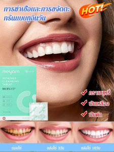 เหล็กจัดฟัน ทำความสะอาด ฆ่าเชื้อ กลิ่นปาก อุทิศ