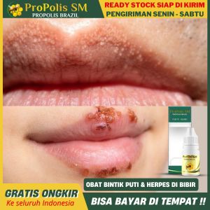 Propolis sm 100 % ASLI - Obat Bintik Putih di Bibir - Obat Herpes di Bibir - Obat Bibir Kering - Obat Sariawan di Bibir - Obat Jamur di Bibir - Penghilang Bintik Putuh - Obat Bibir Pecah Pecah