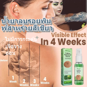 [กำจัดความเจ็บปวด/รวดเร็ว] เครื่องกำจัดรอยสัก/อ่อนโยนและไม่ระคายเคือง/ทำความสะอาดและทำให้รอยสักจางลง