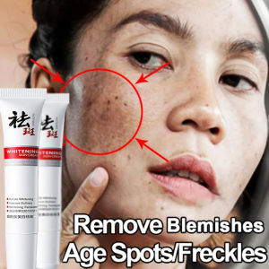 Penghilang flek hitam- Krim Dark spot removal cream 20g Niacinamide Whitening Cream-Bintik noda obat flek hitam paling ampuh Hitam Membandel