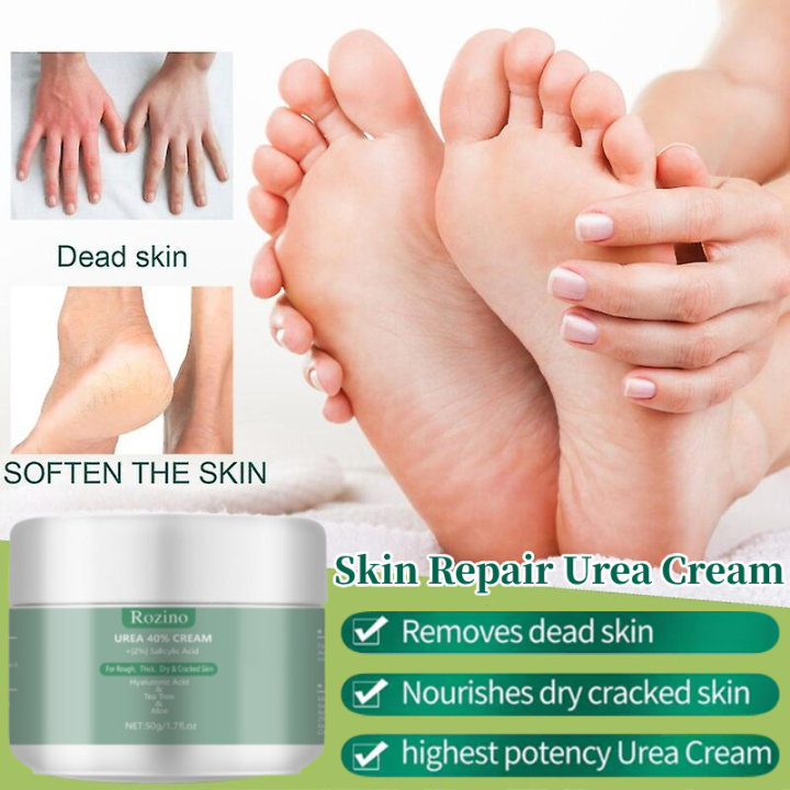 Skin Repair Urea Cream Anti-drying Moisturizing Remove Dead Skin Hand ...